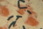 Clostridium perfringens.jpg