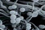 Ruminococcus.jpg
