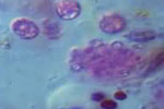 bacteriaspurpurasadelazufre.jpg